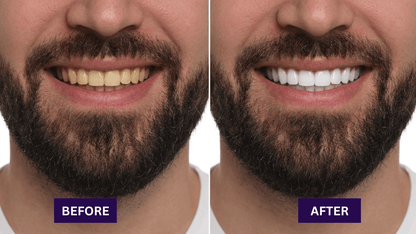 Dr.Whites Purple Whitening Strips